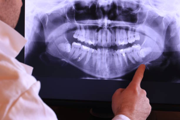 Best Emergency Dentist for Knocked-Out Tooth in Argentine, MI