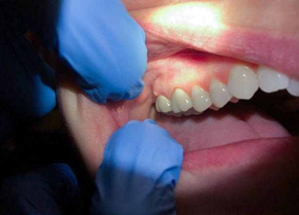 Best Weekend Emergency Dentist in Argentine, MI
